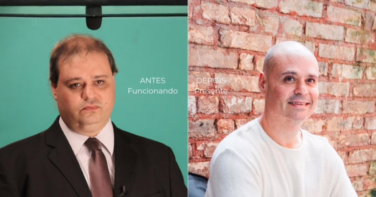 Transformação física antes e depois